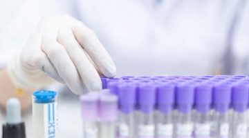 Close-up and selective focus shoot of a microscope